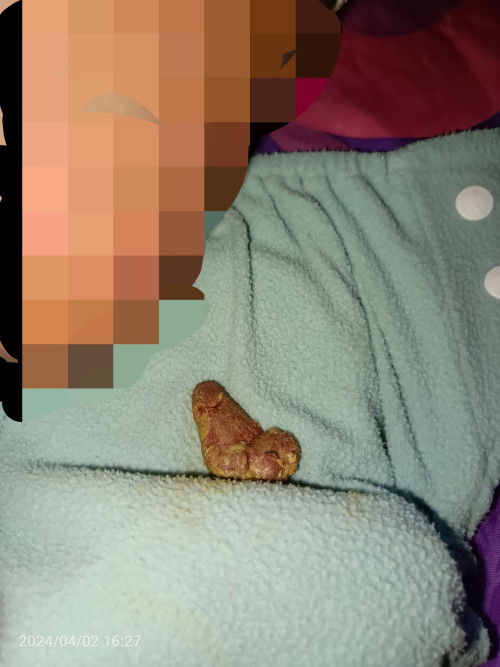 Ciri-ciri bab berdarah seperti apa?