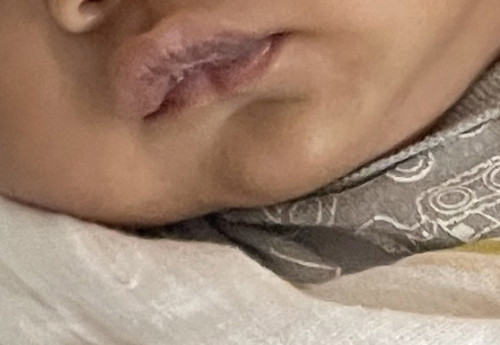 Bibir bayi sy berwrna hitam normal ke? Risau lak sy tpi mmgdari lahir sy perasan gelap 1Bulan 10hari