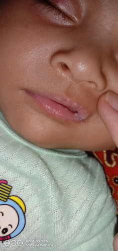 Jamur mulut