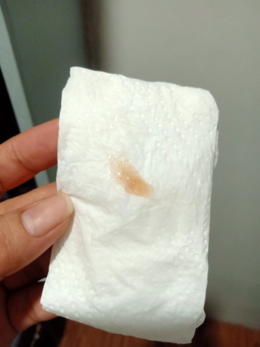 Sign na ba to ng malapit na manganak mga mii? 38 weeks 3 days na po ako, 1cm na kanina. Salamat!
