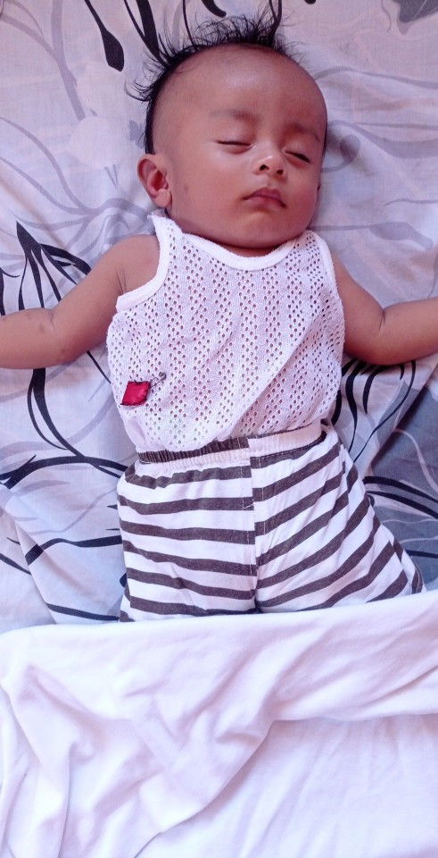 Normal lang po ba ang gantong labi sa baby