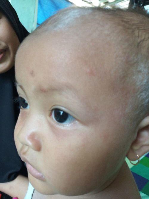 Bintik" Merah di wajah
