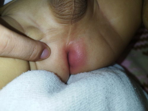 Pigsang dapa po ba ito