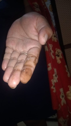 Bun mau tanya td tiba tiba keluar cairan dr jalan keluar ,itu air ketuban atau cuma keputihan ya bun