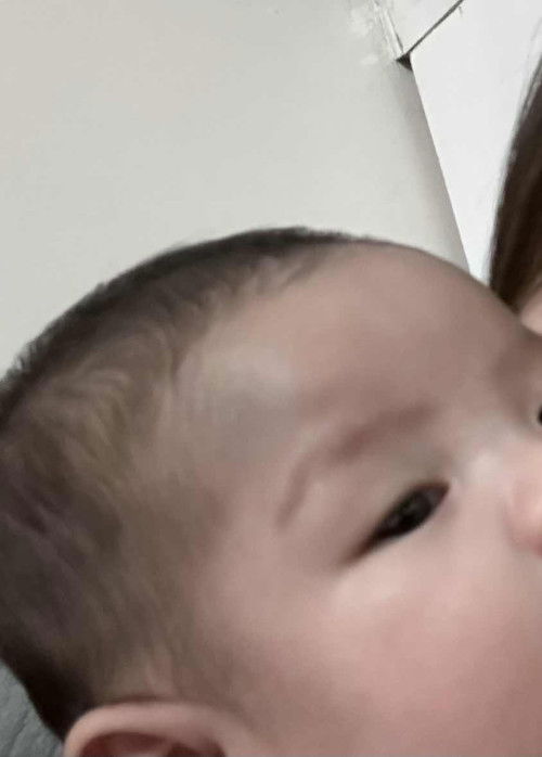 Hi mga momsh! Mag fafade pa po ba ito? Nung bagong panganak ako d nmn po ito visible or birthmark na