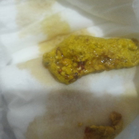 dugo o mucus na dugo sa tae ni baby