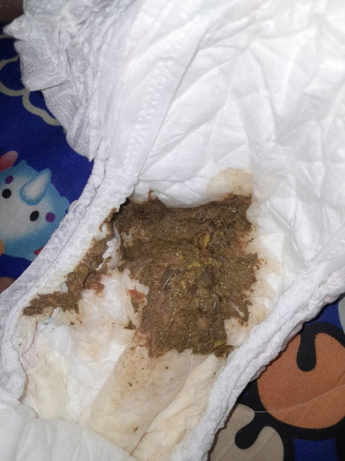 ขอคำแนะนำหน่อยค่ะ.น้อง1ขวบ2เดือน