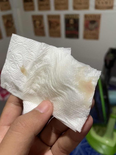 สอบถามแม่ๆหน่อยค่ะ แบบนี้เรียกมูกเลือดรึป่าวค่ะ