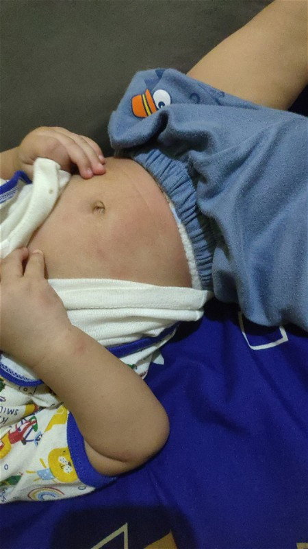 MOHON INFO OBAT GATAL2 UNTUK BABY 7BULAN