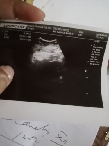 Trkhir haid tggl 27 feb 3xdi tes alhamdulilah positiv priksa kedokter Masi kecil apa ya normal ini ?