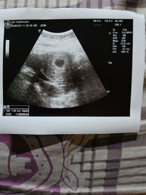 Kantong janin 6 weeks