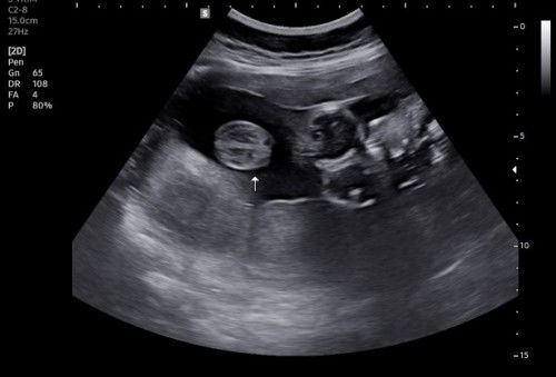 ช่วยดูหน่อยค่ะ