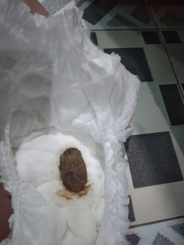 bun,beberapa hri ini ank sy pup nya perti ini,normal gk y usia 9bln pup kyk gni (maaf jorok)