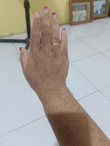 Misi bun, ada gak yang kayak aku , tm 3 & menuunggu persalinan, muncul bintik2 hitam seperti ini