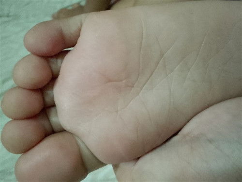 nakalmot ng pusa sa paa may rabie naba jan sa paa