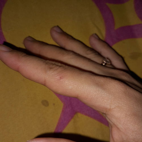 Dicakar kucing usia hamil 16 minggu