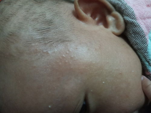 Ada yang pernah pakai produk moell multipurpose balm untuk bintik" di muka? 
efeknya gmna ya?