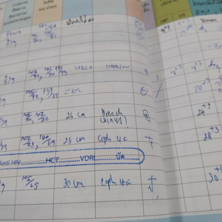 ท่าเด็กส่วน นำ/การลง