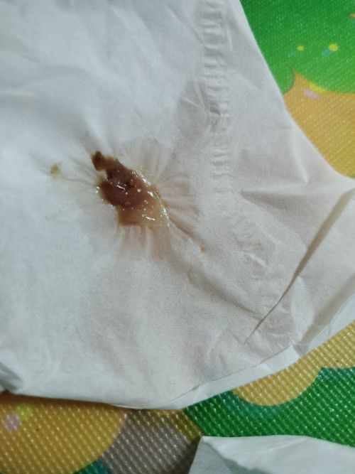 Hpl 12April hamil 39week