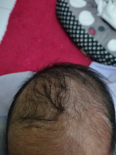 Bun shering dong buat bersihin kepala bayi baru lahir pakek apa ya ,,yg aman biar ga sensitif #