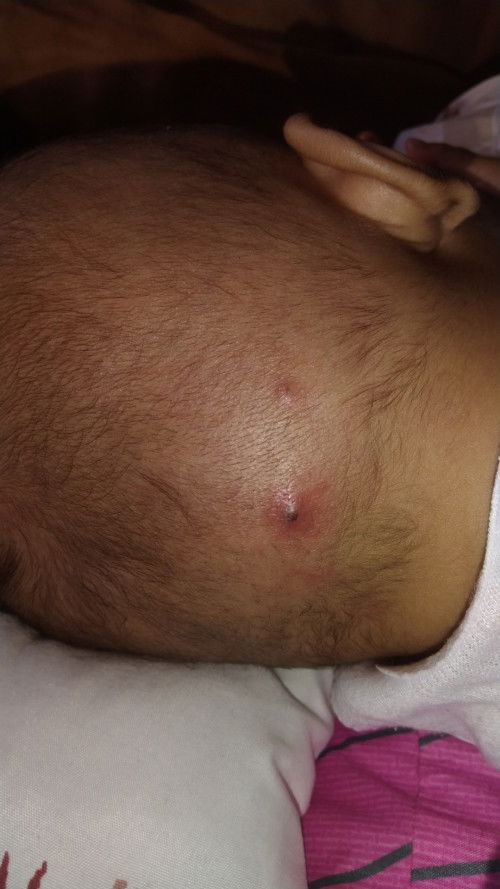 Bintik merah dikepala