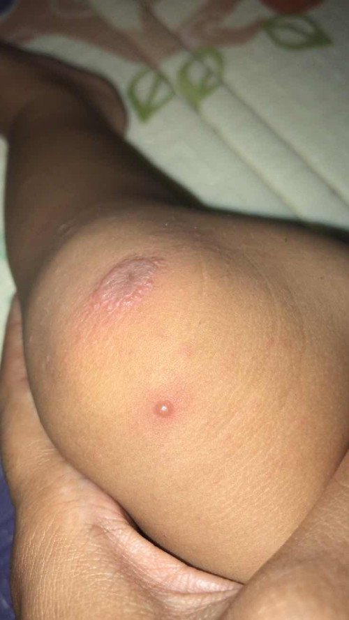 Kulit kaki