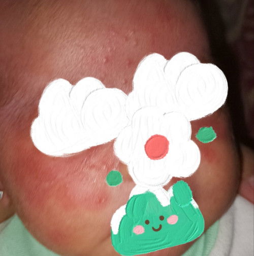 WAJAH BAYI BRUNTUSAN DAN MERAH