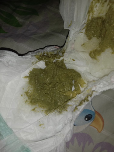 ถ่ายเหนียว