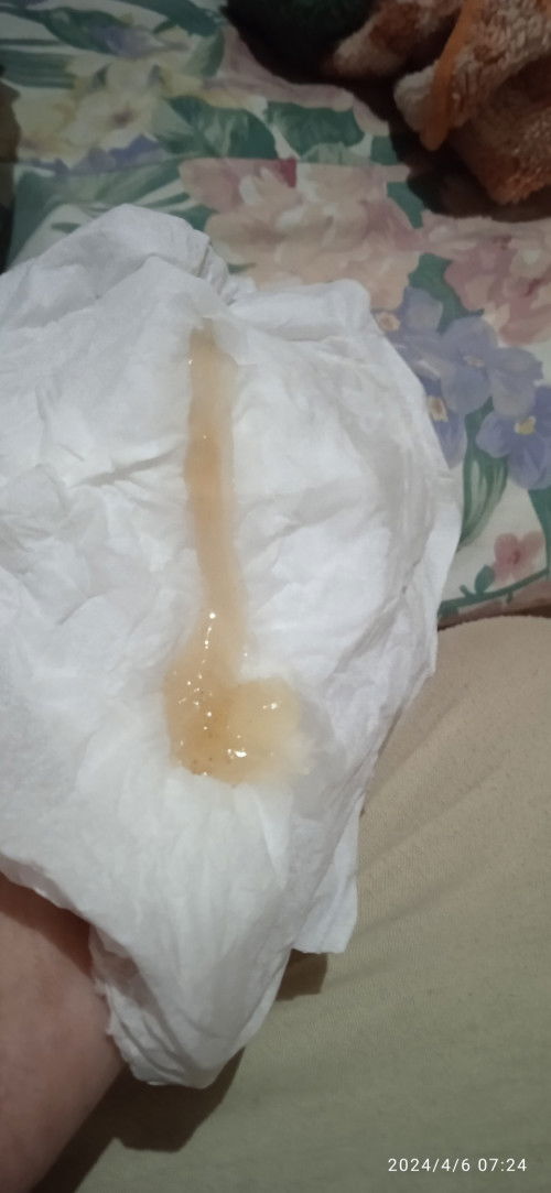 Apakah tanda" Mau lahiran?