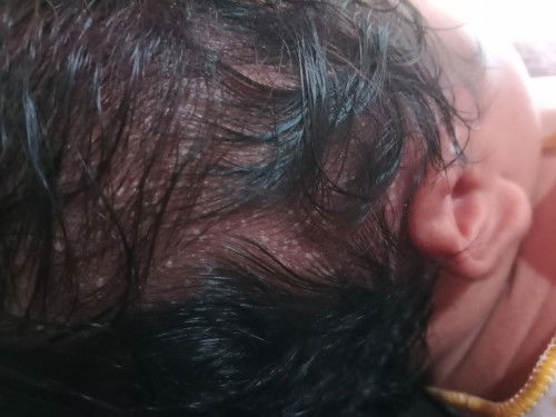 Bayi aku Muncul bintik bintik seperti ini bun, ini apa ya??