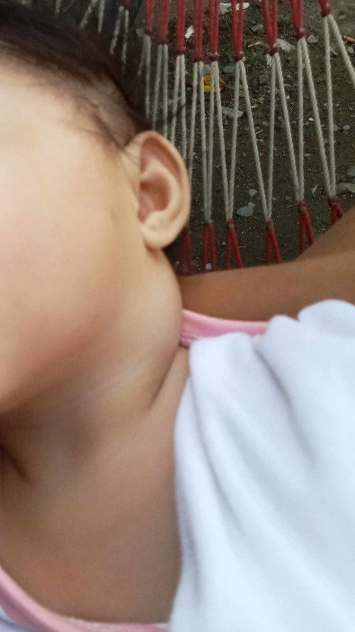 Ano kaya ito mi pinapainom ko nmn ng antibiotic mums daw sabi eh nilagyan ko ng tina ngayon