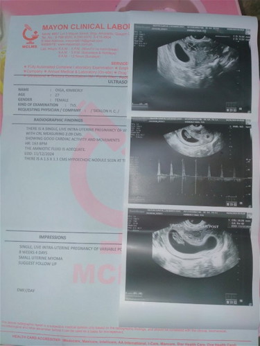 Ultrasound result