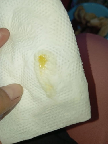 ต่อนี้ 32 วิค