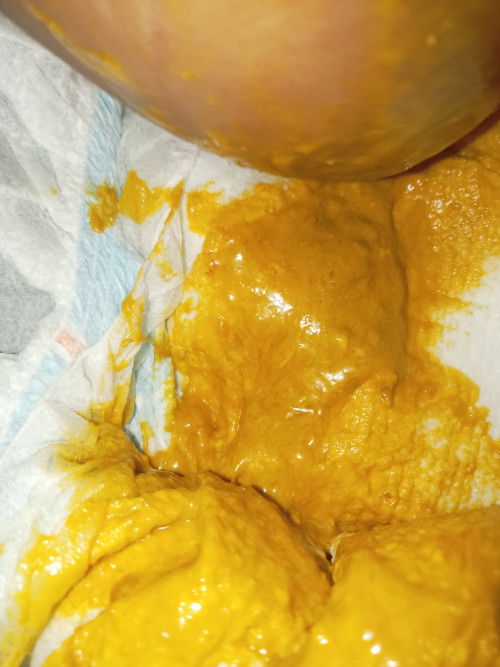 2months ng basa ang tae ng baby ko turning 6moths old . Normal ba?