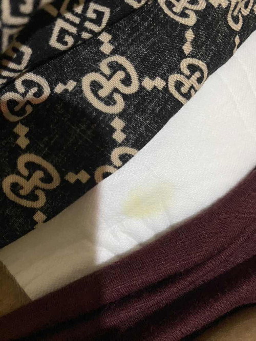 Abis sc diperban berbekas kuning, kenapa ya. Ada yg sama ga