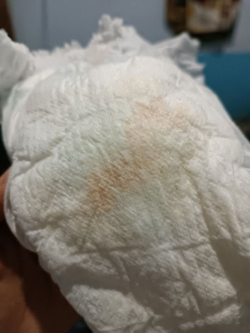 Diapers bercak merah