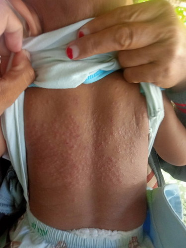 Bintik merah di Badan