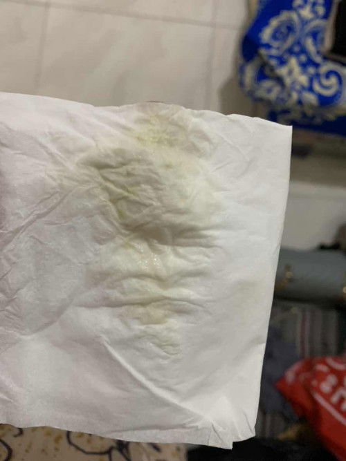 keputihan atau ketuban?