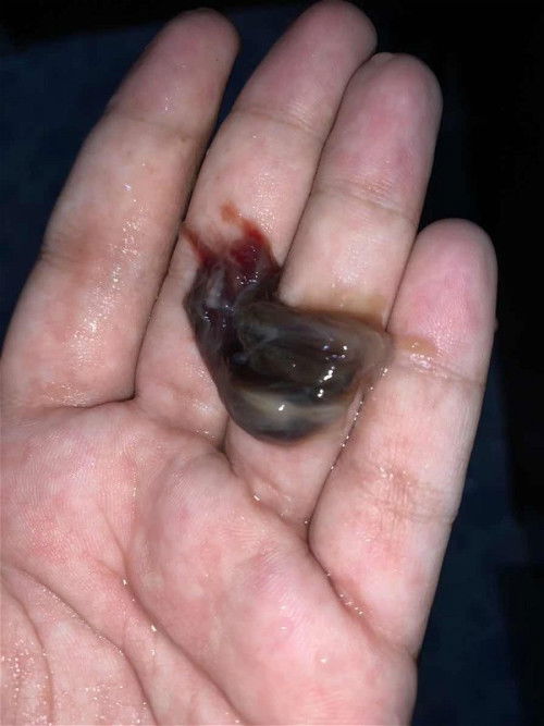 Apakah ini mucus plug?