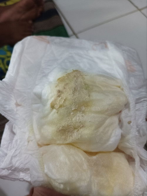 Bayi 1 bulan 23 hari