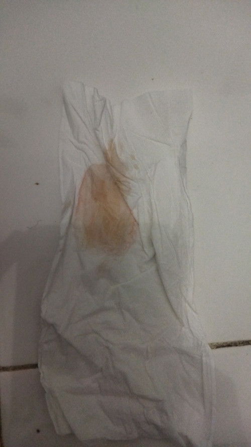 Keluar flek seperti air tapi kayak darah