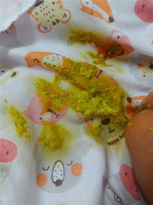 น้องกินนมผง อึปกติไหมคะ?