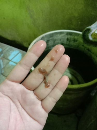 เมื่อวานไปตรวยภายในปากมดลูกเปิด2เซ็นตื่นเช้ามามีแบบนี้ผิดปกติมั้ยคะ กำหนด23เมษานี้ค่ะ 🥹🥺