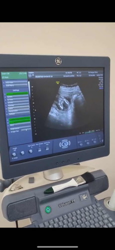 17w+1 แม่ๆช่วยเดาเพศหน่อยค่ะ
