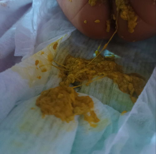 สอบถามหน่อย  อึน้องเป็นแบบนี้ปกติมั้ยคะ