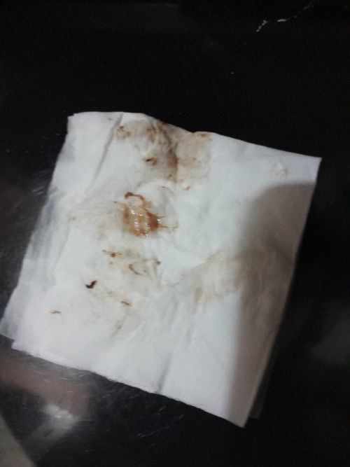 Flek coklat kehamilan 4 minggu