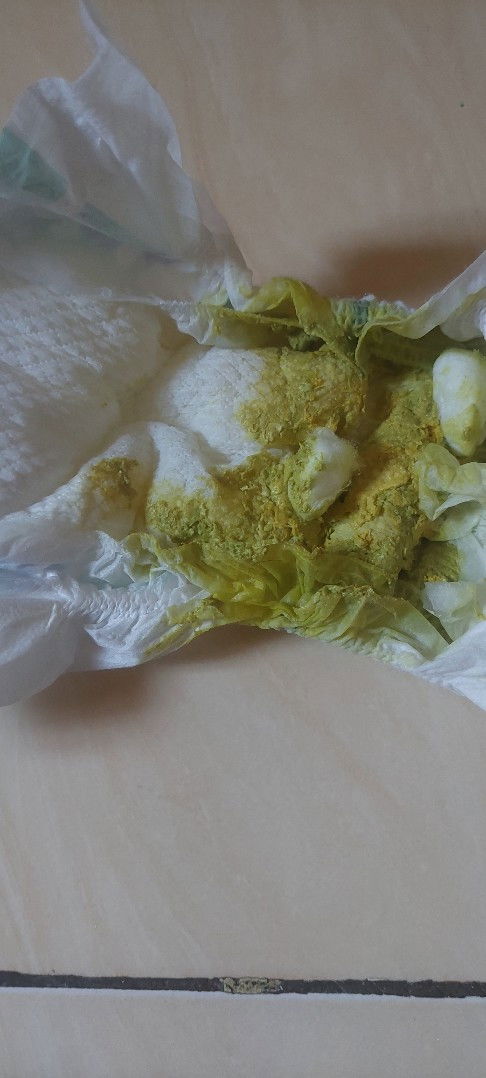 Bun klo poop si kecil kea gini tanda apa ya?