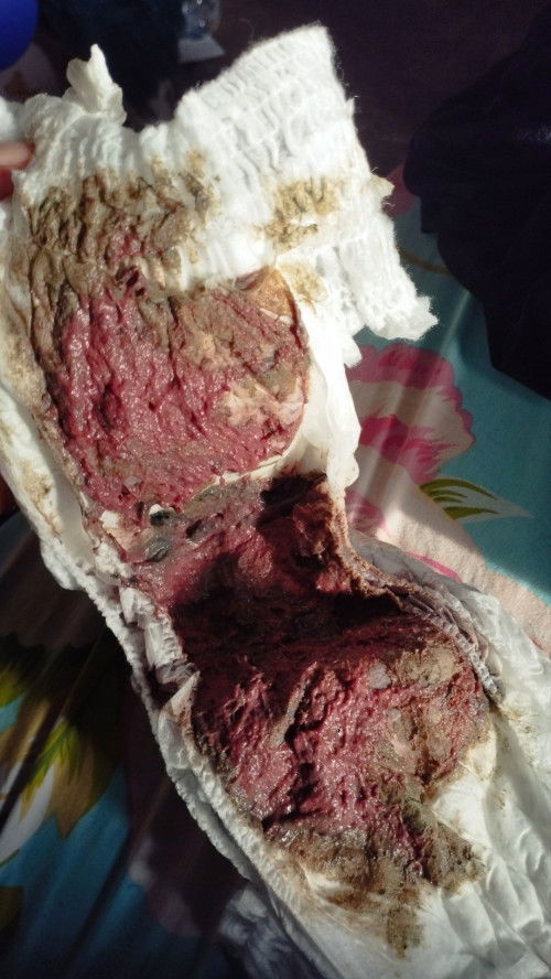 poop bayi, maaf jijik