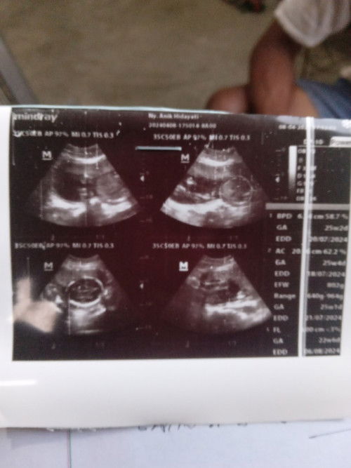 Jk baby bisa berubah atau tidak