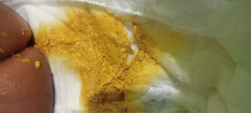 feses bayi umur sebulan